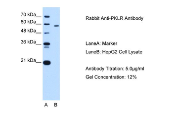 PKLR Rabbit Polyclonal Antibody