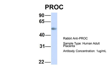 PROC Rabbit Polyclonal Antibody