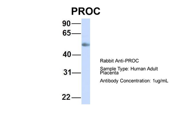 PROC Rabbit Polyclonal Antibody