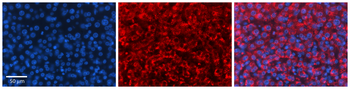 PROC Rabbit Polyclonal Antibody