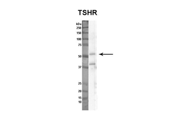 TSHR Rabbit Polyclonal Antibody