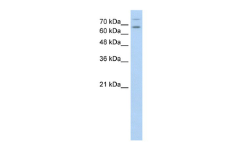 TSHR Rabbit Polyclonal Antibody