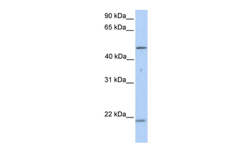 KRT10 Rabbit Polyclonal Antibody