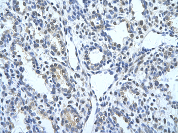 KRT17 Rabbit Polyclonal Antibody
