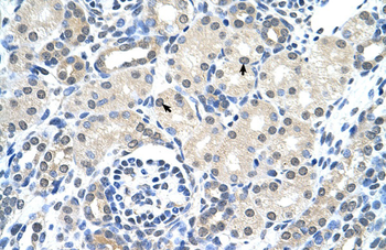 KRT17 Rabbit Polyclonal Antibody