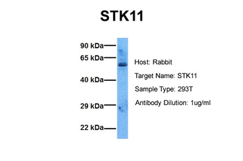 STK11 Rabbit Polyclonal Antibody