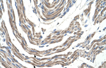 STK11 Rabbit Polyclonal Antibody