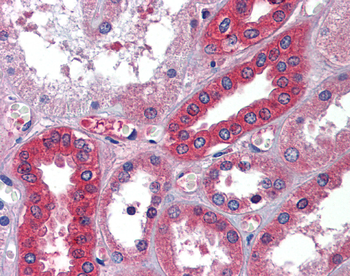 ALB Rabbit Polyclonal Antibody