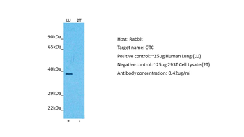 OTC Rabbit Polyclonal Antibody