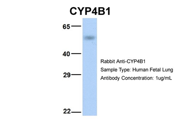 CYP4B1 Rabbit Polyclonal Antibody
