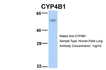 CYP4B1 Rabbit Polyclonal Antibody
