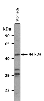 NPY1R Rabbit Polyclonal Antibody