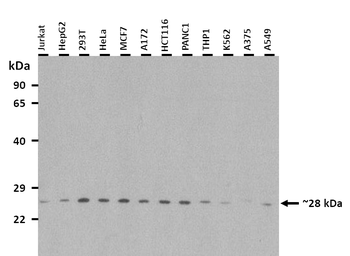 TSHR Rabbit Polyclonal Antibody