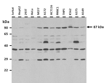 TSHR Rabbit Polyclonal Antibody