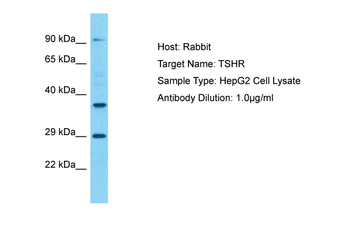 TSHR Rabbit Polyclonal Antibody