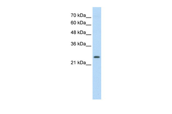 TSHR Rabbit Polyclonal Antibody