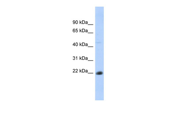 CD40 Rabbit Polyclonal Antibody