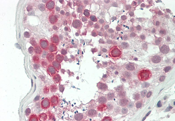 CRMP1 Rabbit Polyclonal Antibody