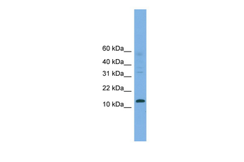 CRABP2 Rabbit Polyclonal Antibody