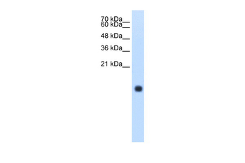 CST4 Rabbit Polyclonal Antibody