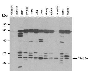 Dpt Rabbit Polyclonal Antibody