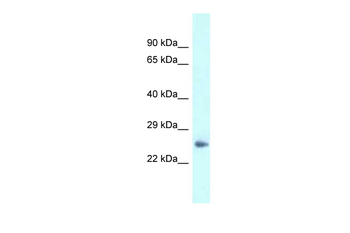 Dpt Rabbit Polyclonal Antibody