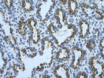 KRT8 Rabbit Polyclonal Antibody