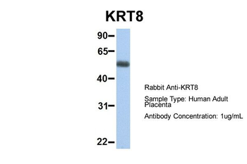 KRT8 Rabbit Polyclonal Antibody