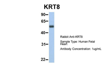 KRT8 Rabbit Polyclonal Antibody