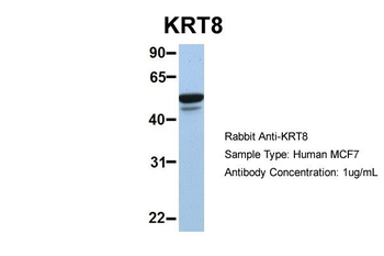 KRT8 Rabbit Polyclonal Antibody