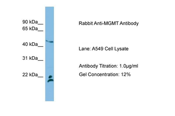 MGMT Rabbit Polyclonal Antibody