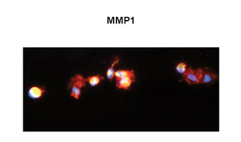 MMP1 Rabbit Polyclonal Antibody