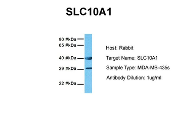 SLC10A1 Rabbit Polyclonal Antibody