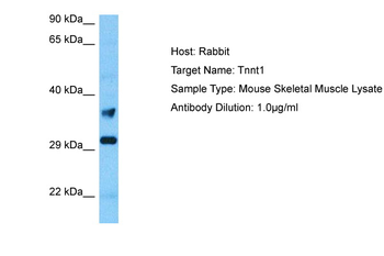 TNNT1 Rabbit Polyclonal Antibody