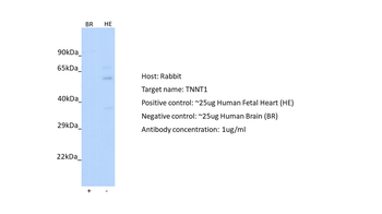 TNNT1 Rabbit Polyclonal Antibody