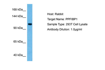 PPFIBP1 Rabbit Polyclonal Antibody