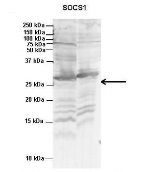 SOCS1 Rabbit Polyclonal Antibody