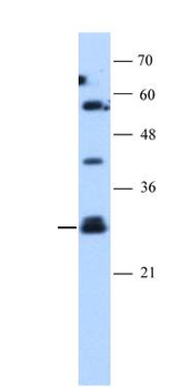SOCS1 Rabbit Polyclonal Antibody