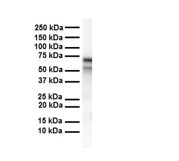 CES2 Rabbit Polyclonal Antibody