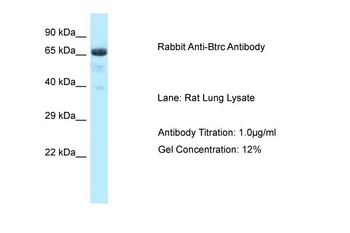 Btrc Rabbit Polyclonal Antibody