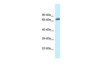 Btrc Rabbit Polyclonal Antibody