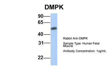 DMPK Rabbit Polyclonal Antibody