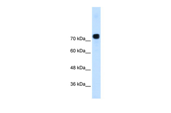 ACTN4 Rabbit Polyclonal Antibody
