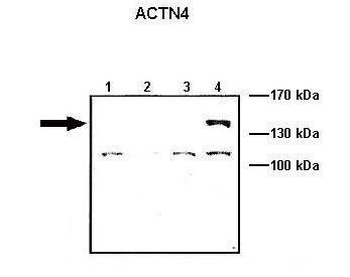ACTN4 Rabbit Polyclonal Antibody