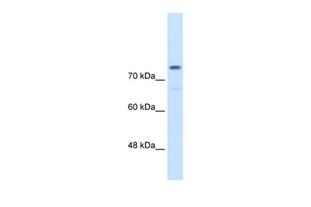 ACTN4 Rabbit Polyclonal Antibody