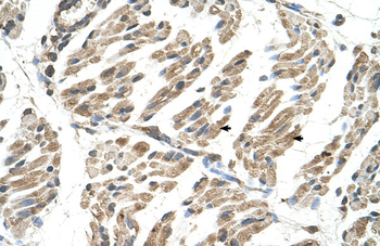 SLC6A8 Rabbit Polyclonal Antibody