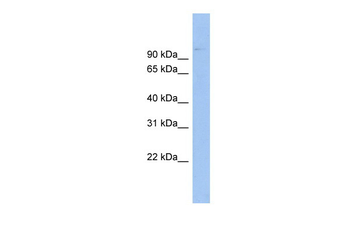 ABCB6 Rabbit Polyclonal Antibody