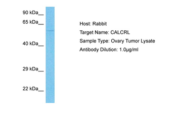 CALCRL Rabbit Polyclonal Antibody