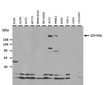 MYH1 Rabbit Polyclonal Antibody