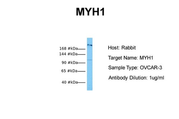 MYH1 Rabbit Polyclonal Antibody